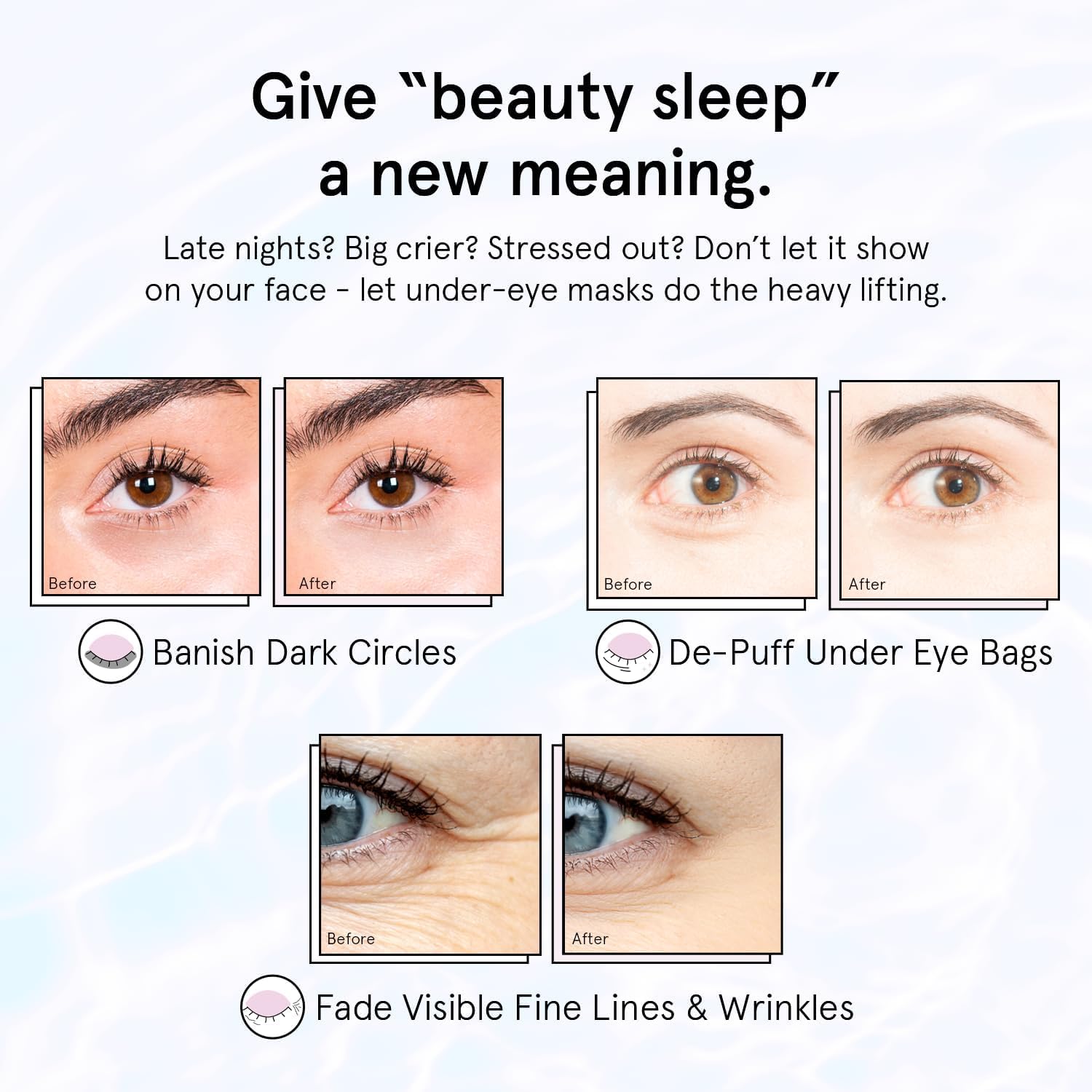 grace & stella Under Eye Patches for Puffy Eyes and Dark Circles (Retinol, 24 Pairs) Restoring Gel Under Eye Masks with Hyaluronic Acid - Vegan Cruelty-Free Skincare Birthday Gifts for Women image 4