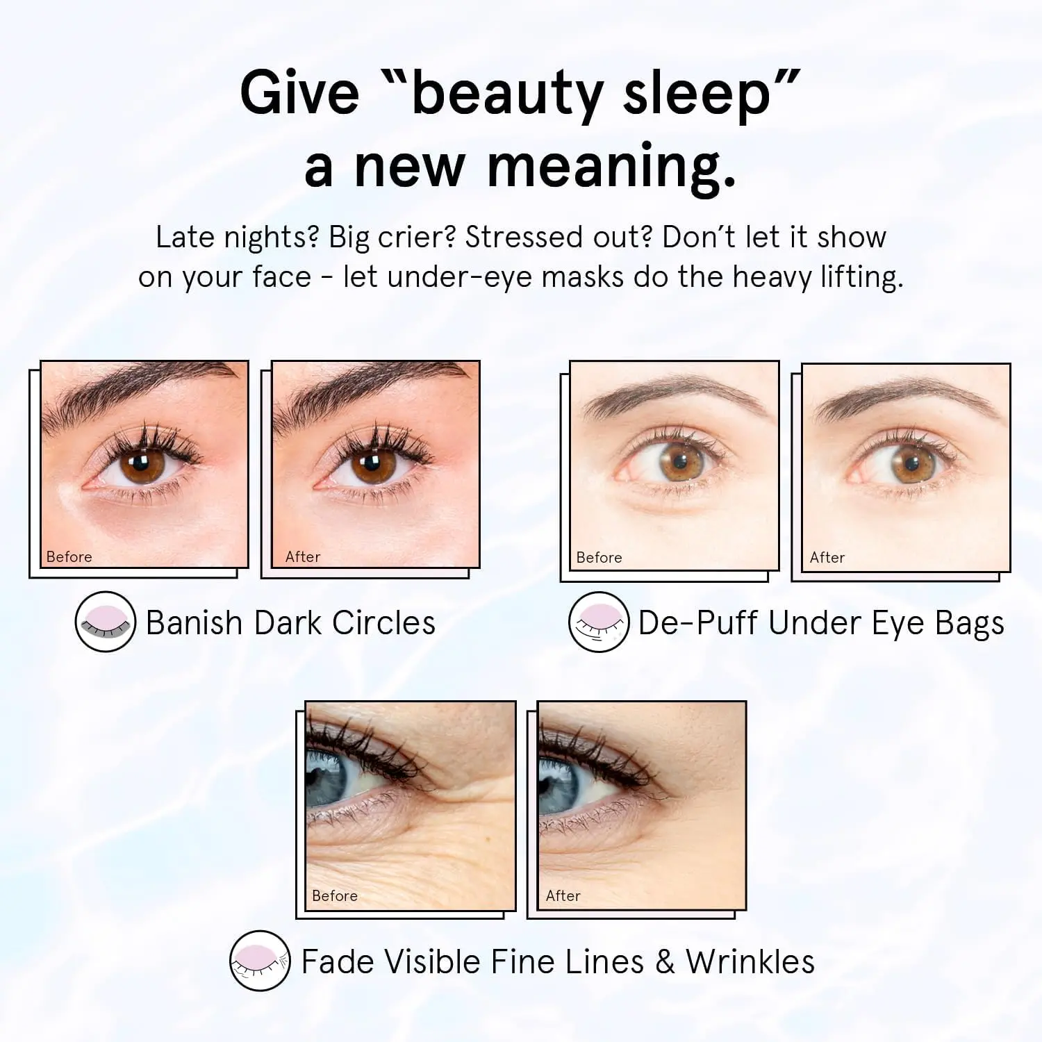 grace & stella Under Eye Patches for Puffy Eyes and Dark Circles (Retinol, 24 Pairs) Restoring Gel Under Eye Masks with Hyaluronic Acid - Vegan Cruelty-Free Skincare Birthday Gifts for Women image 4